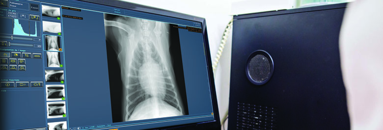 COVETO - Comment fonctionne la radiologie numérique ?